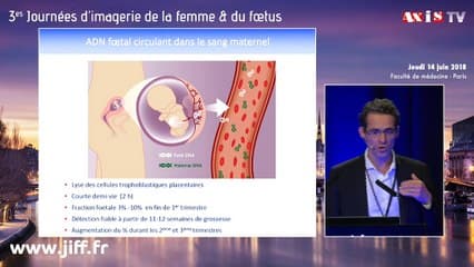 Problèmes éthiques posés par l’extension du DPNI au-delà de la trisomie 21