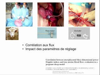 Quantification de la vascularisation utéro-placentaire par écho-angiographie Doppler 3D