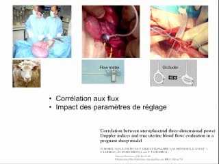 Quantification de la vascularisation utéro-placentaire par écho-angiographie Doppler 3D
