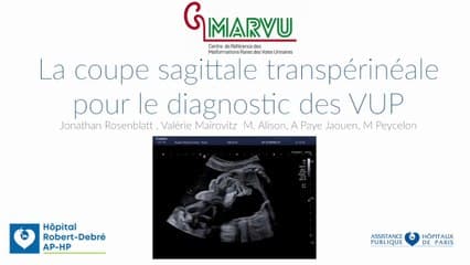 La coupe sagittale périnéale pour le diagnostic des VUP