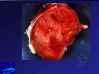 Echographie cérébrale foetale et infections