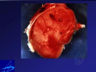 Echographie cérébrale foetale et infections