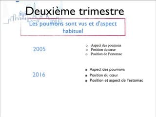 Recommandations CNEOF 2016 : les inchangés et les nouveautés Thorax