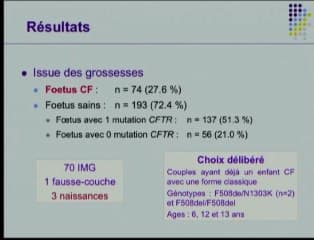 Mucoviscidose : bilan de 18 ans de diagnostic anténatal de mucoviscidose en Bretagne