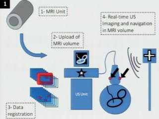 Imagerie en fusion multimodalité (écho-IRM) en prénatal