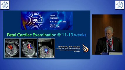 Examen cardiaque foetal entre 11 et 13 SA