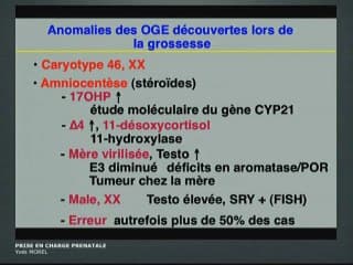 Anomalies des organes génitaux externe : Prise en charge prénatale
