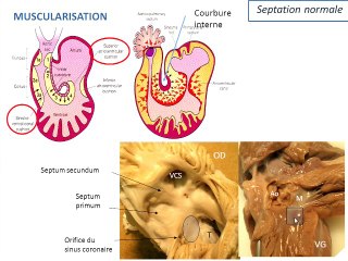 Embryologie du canal atrio ventriculaire
