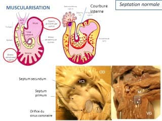 embryologie du canal atrio ventriculaire