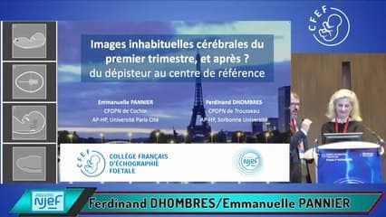 Images inhabituelles cérébrales du premier trimestre ? Et après ? Du Dépisteur au Centre de Référence