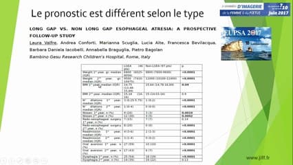Thorax, génétique ? Atrésie de l'ésophage : orientations thérapeutiques