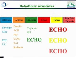 Epanchements thoraciques hydrothorax chylothorax
