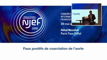 COEUR Faux positifs des coarctations de l'aorte : déséquilibres par petit coeur gauche et par gros coeur droit