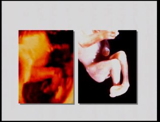 Quel bilan morphologique ? Quelles pathologies ?