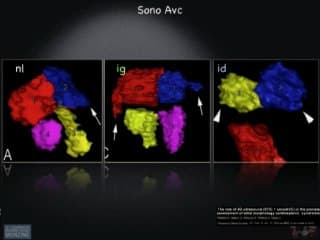 Place de l’échocardiographie fœtale 3D