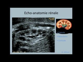 Uropathies : Information et prise en charge médico-chirurgicale / lieu d’accouchement