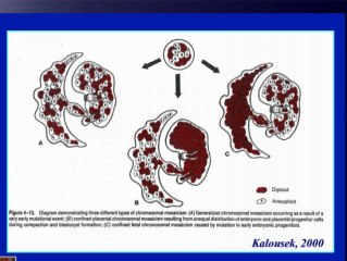RCIU mosaïque confinée au placenta