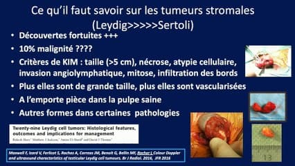 Imagerie dans le cadre du bilan de fertilité de l'homme