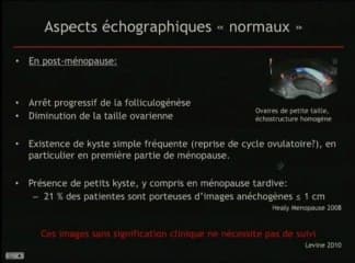 L’endométriose Découverte fortuite en échographie. Que faut-il faire ?