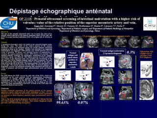 Dépistage échographique de la malrotation.
