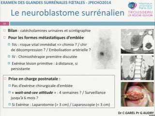 Examiner les surrénalesL’aspect échographique normal, l’examen de dépistage et les signes pathologiques. Quelles conséquencespour les collègues périnatalogistes ?