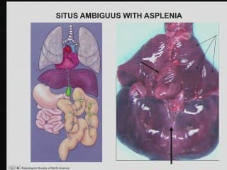 Le situs et ses pathologies