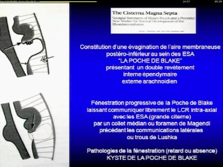 Le cerveau : de la mesure au diagnostic Application : cas cliniques