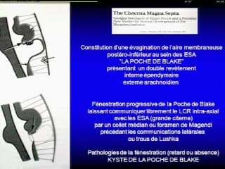Le cerveau : de la mesure au diagnostic Application : cas cliniques