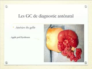 Pronostic du grêle court, registre du Sud-Est sur les 10 dernières années.