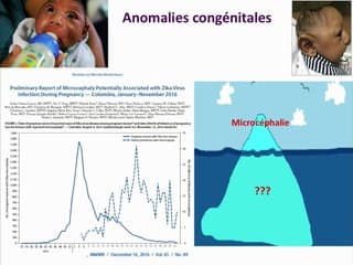 FOETOPATHIE CONGÉNITALE LIÉE AU VIRUS ZIKA: QUE RECHERCHER EN ÉCHOGRAPHIE PRÉNATALE, À PARTIR DES DONNÉES PUBLIÉES PRE ET POST NATALES.