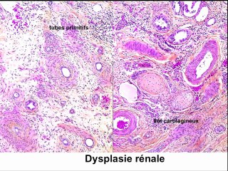Apport de la foetopathologie en cas d'IMG