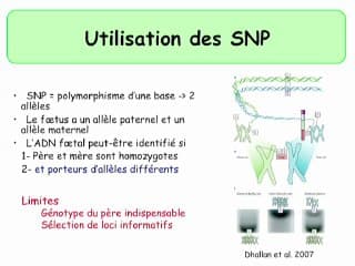 L'ADN foetal pourrait-il être à l'origine d'un test de dépistage de masse de la T21?