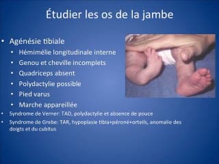 Echographie 2D/3D : jusqu'où peut-on aller ?