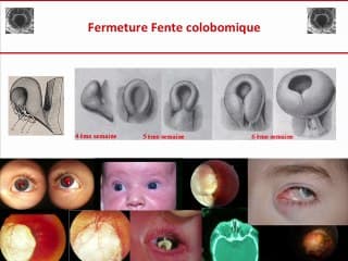Développement de l'oeil : embryologie, gènes du développement