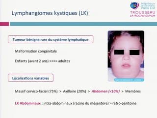 Diagnostic prénatal des lymphangiomes kystiques abdominaux