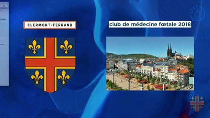 56 Lorsque les malformations du cloisonnement uro-rectal (URSM) sont révélées par une mégavessie du 1er tirmestre