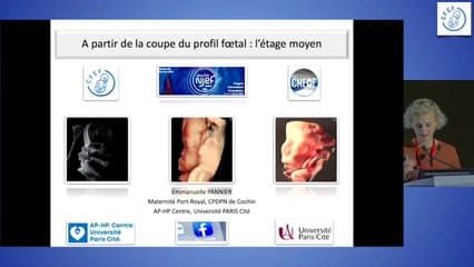 A partir de la coupe du profil : étage moyen