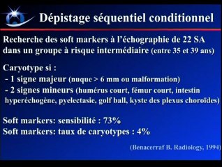 Pourquoi faut-il dépister la trisomie 21 au 1er trimestre de la grossesse ?