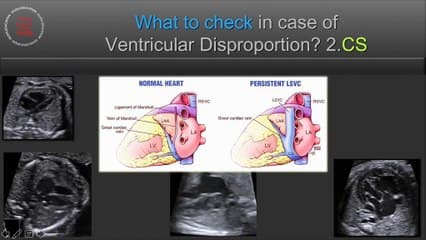 Comment j’examine le coeur foetal ? Trucs et astuces (français)