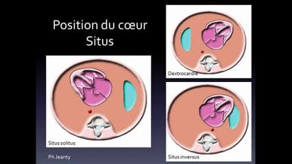 L'examen du coeur aujourd'hui : Quelle évolution au quotidien par rapport aux coupes du CTE de 2005 ?