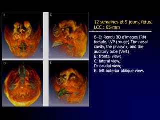 Bibliographie récente en imagerie de la face