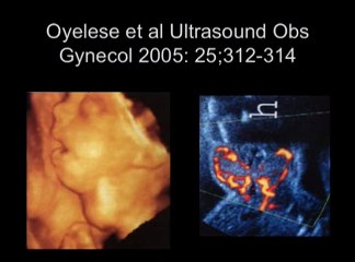 Thyroïde et grossesse : éléments cliniques et imagerie