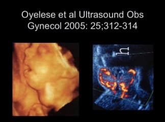 Thyroïde et grossesse : éléments cliniques et imagerie