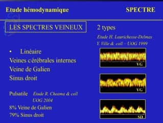 Anatomie et physiologie de la circulation cérébrale foetale
