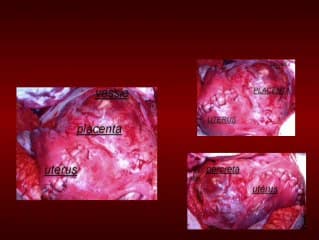 Les gros placentas
