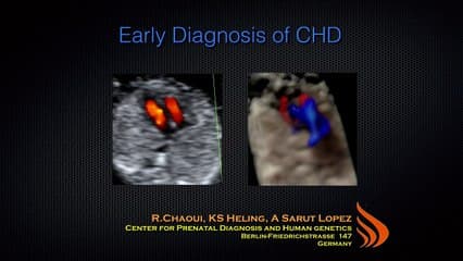 Une autre façon de regarder le foetus au 1er trimestre la coeur