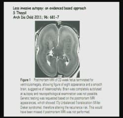 Autopsie virtuelle historique