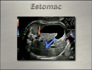 Imagerie du péristaltisme foetal
