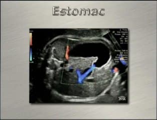 Imagerie du péristaltisme foetal