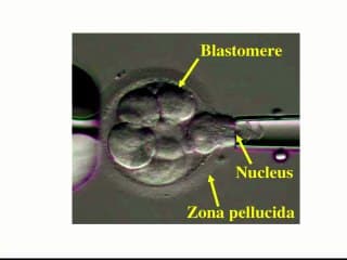 Le DPI après une IMG ? Perspectives